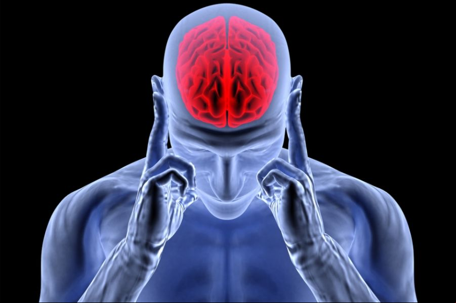 Cerebro